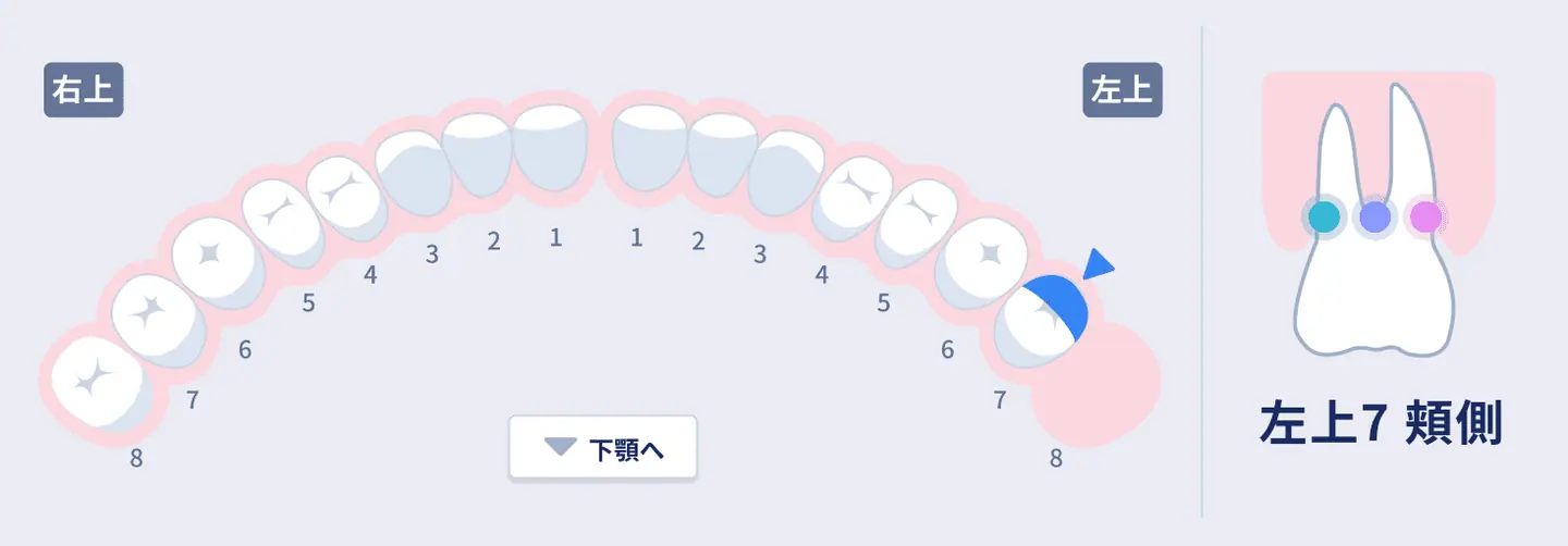 Concept showing the active tooth surface